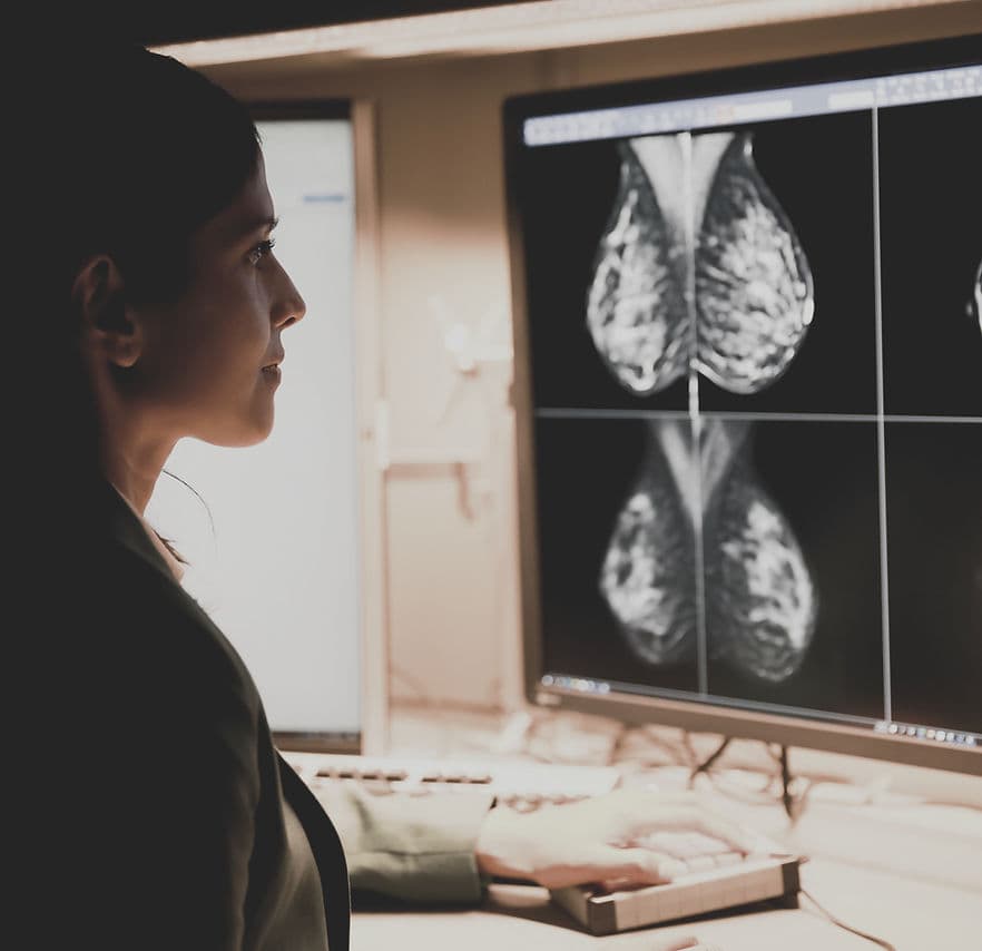 Canberra Breast imaging equipment