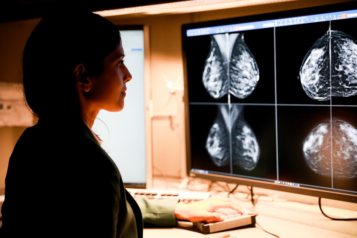 A radiologist reviewing mammography images on a large diagnostic display
